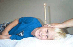 Thermo-Auricular Therapy Image